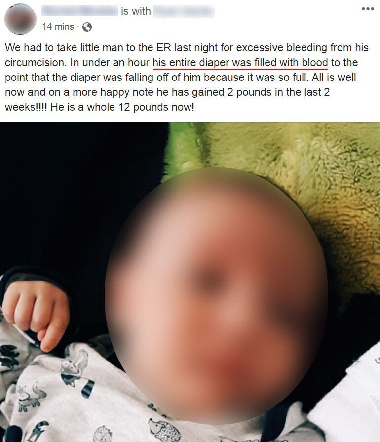 bleeding -''his diaper alsmost fell off him''