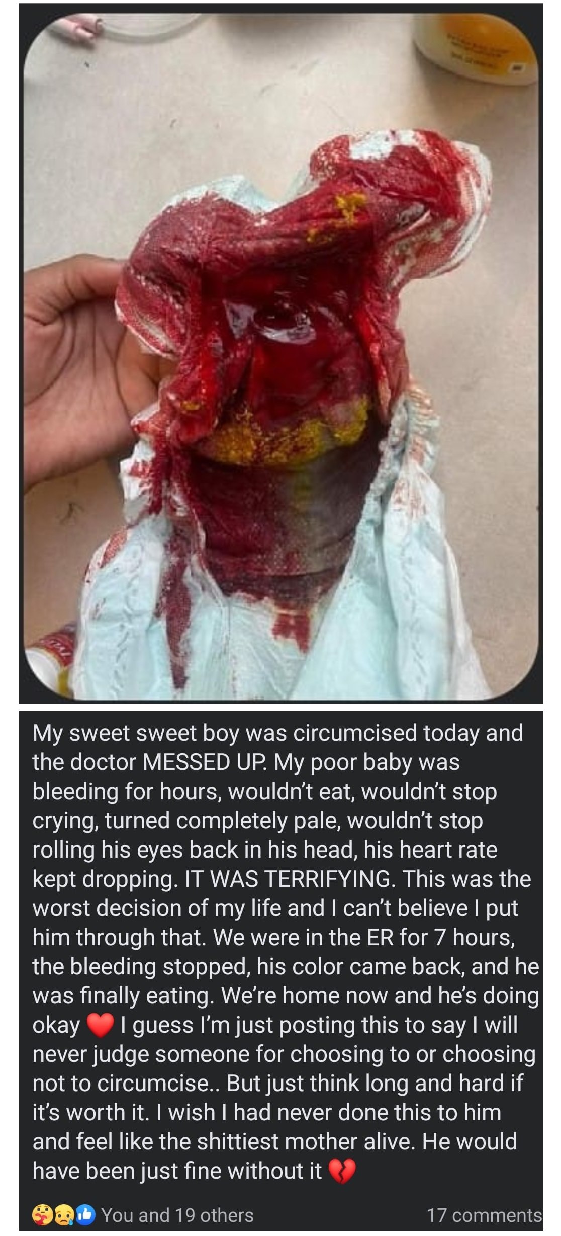 Image: a blood-soaked diaper Text: "My sweet seeet boy was circumicised today and the doctor MESSED UP. 
                               My poor baby was bleeding for hours, wouldn't eat, wouldn't stop crying, turned completely pale,                                wouldn't stop rolling his eyes back in his head, his heart rate kept dropping. IT WAS TERRIFYING. 
                               This was the worst decision of my life and I can't believe I put him through that.                                We were in the ER for 7 hours, the bleeding stopped, his colour came back, and he was finally eating. 
                               We're home now and he's doing okay [heart] I guess I'm just posting this to say I will neer judge someone                                for choosing to or choosing not to circumcise.. But just think long and hard if it's worth it. 
                               I wish I had never done this to him and I feel like the shittiest mother alive.                                He would have been just fine without it. [broken heart]