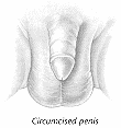 Sketch of circumcised penis