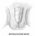 Sketch of intact penis