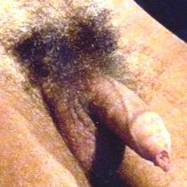 Spouty penis, less flaccid
